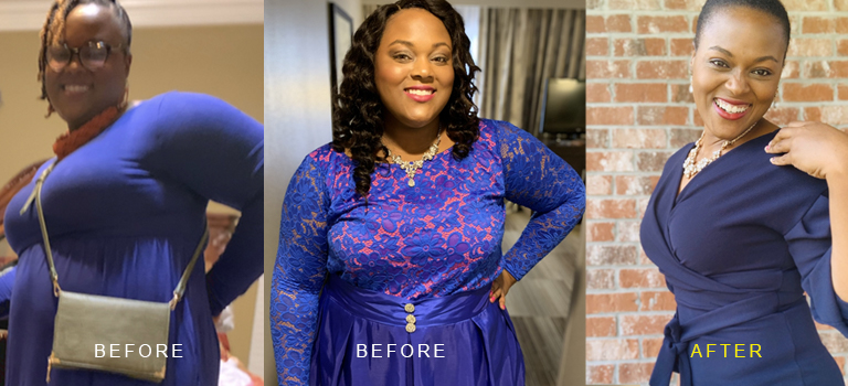 Brittany’s Weight Loss Surgery Story